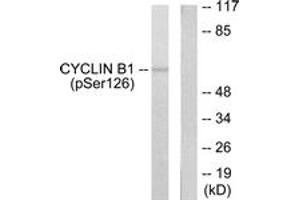 Western blot analysis of extracts from NIH-3T3 cells treated with EGF 200ng/ml 15', using Cyclin B1 (Phospho-Ser126) Antibody. (Cyclin B1 抗体  (pSer126))