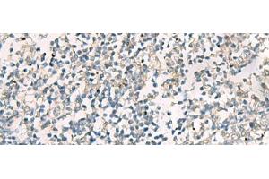 Immunohistochemistry of paraffin-embedded Human tonsil tissue using SERPINB4 Polyclonal Antibody at dilution of 1:40(x200) (SERPINB4 抗体)
