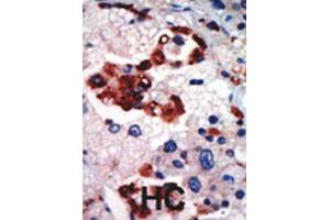 Immunohistochemistry (IHC) image for anti-Protein Kinase C, iota (PRKCI) antibody (ABIN3002935)