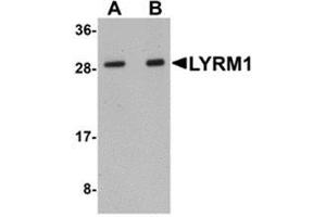 Western blot analysis of LYRM1 in human liver tissue lysate with LYRM1 antibody at (A) 1 and (B) 2 μg/ml. (LYRM1 抗体  (Center))