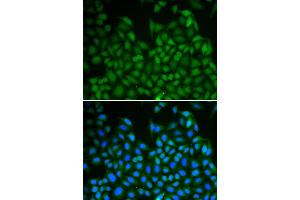 Immunofluorescence analysis of A549 cell using LHX8 antibody. (LHX8 抗体)