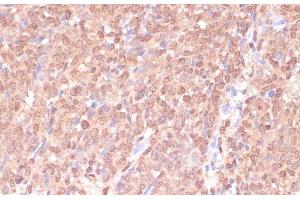 Immunohistochemistry (Paraffin-embedded Sections) (IHC (p)) image for anti-RAD50 Homolog (S. Cerevisiae) (RAD50) antibody (ABIN7010313)