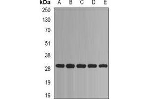 Western blot analysis of PSMA1 expression in Jurkat (A), Hela (B), HepG2 (C), mouse liver (D), mouse heart (E) whole cell lysates. (PSMA1 抗体)