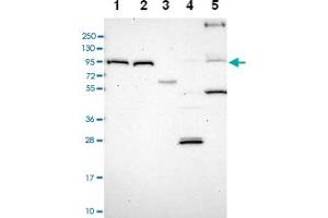 Western blot analysis of Lane 1: RT-4 Lane 2: U-251 MG Lane 3: Human Plasma Lane 4: Liver Lane 5: Tonsil with TRPV2 polyclonal antibody . (TRPV2 抗体)