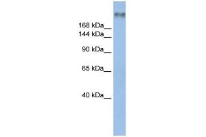 WB Suggested Anti-SCN8A Antibody Titration:  0. (SCN8A 抗体  (Middle Region))