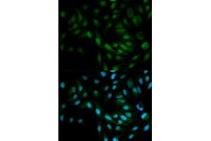 Immunofluorescence analysis of MCF7 cell using MAPK7 antibody. (MAPK7 抗体)