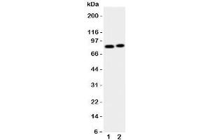 Western blot testing of Gelsolin antibody and Lane 1: HeLa;  2: A431 cell lysate. (Gelsolin 抗体  (AA 763-775))