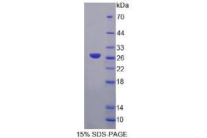 SDS-PAGE analysis of Human GFM2 Protein. (GFM2 蛋白)