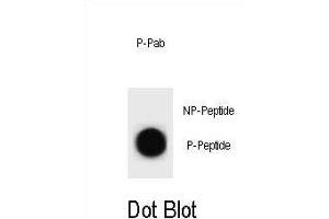 Dot blot analysis of CCNB2 Antibody (Phospho ) Phospho-specific Pab (ABIN1881159 and ABIN2839951) on nitrocellulose membrane. (Cyclin B2 抗体  (pThr359))