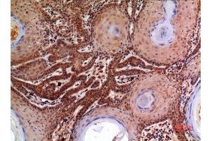 Immunohistochemistry (IHC) analysis of paraffin-embedded Human Skin, antibody was diluted at 1:100. (alpha 2 Macroglobulin 抗体  (Internal Region))