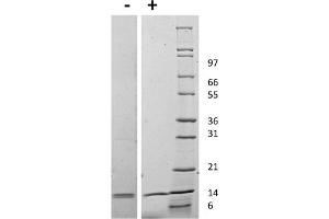 SDS-PAGE (SDS) image for Interleukin 31 (IL31) protein (ABIN6700122)