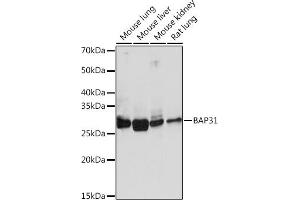 Western blot analysis of extracts of various cell lines, using B Rabbit mAb (ABIN1680181, ABIN7101458, ABIN7101459 and ABIN7101460) at 1:1000 dilution. (BCAP31 抗体)