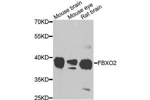 Western blot analysis of extracts of various cell lines, using FBXO2 antibody (ABIN5995854) at 1/1000 dilution. (FBXO2 抗体)