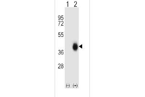 Western blot analysis of FCAR (arrow) using rabbit polyclonal FCAR Antibody (Center) (ABIN656839 and ABIN2846047). (FCAR 抗体  (AA 58-84))