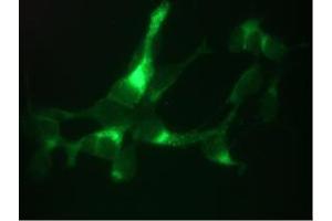 Immunofluorescent staining of LNCaP cells. (Prostate Specific Antigen 抗体)
