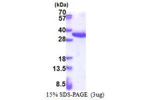SDS-PAGE (SDS) image for Ribosomal Protein S4, X-Linked (RPS4X) (AA 1-263) protein (His tag) (ABIN5853413) (RPS4X Protein (AA 1-263) (His tag))