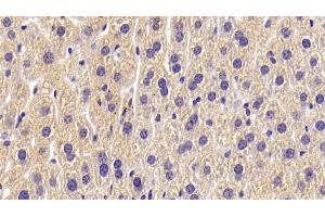Detection of ALPL in Mouse Liver Tissue using Polyclonal Antibody to Alkaline Phosphatase, Tissue-nonspecific (ALPL) (ALPL 抗体  (AA 18-335))