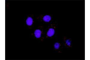 Representative image of Proximity Ligation Assay of protein-protein interactions between IKBKB and CTNNB1. (IKBKB & CTNNB1 Protein Protein Interaction Antibody Pair)