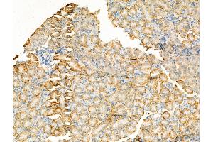 ABIN7094494 and ABIN7098543 at 1/100 staining Mouse kidney tissue by IHC-P.