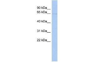 TIGD1 antibody used at 1 ug/ml to detect target protein. (IGD1 抗体  (Middle Region))