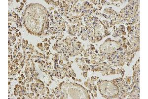 Immunohistochemistry (IHC) image for anti-4-Aminobutyrate Aminotransferase (ABAT) antibody (ABIN1876487) (ABAT 抗体)
