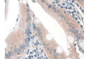 Immunohistochemistry (IHC) image for anti-Guanidinoacetate N-Methyltransferase (GAMT) (AA 2-236) antibody (ABIN7444211)