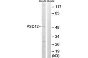 Western blot analysis of extracts from HepG2 cells, using PSMD12 Antibody. (PSMD12 抗体  (AA 151-200))