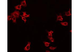 ABIN6266893 staining HepG2 by IF/ICC. (DOK3 抗体  (Internal Region))