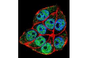 Confocal immunofluorescent analysis of TRADD Antibody (Center) with Hela cell followed by Alexa Fluor 488-conjugated goat anti-rabbit lgG (green). (TRADD 抗体  (Middle Region))