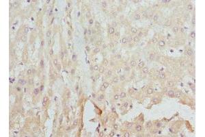 Immunohistochemistry of paraffin-embedded human liver tissue using ABIN7152931 at dilution of 1:100 (FCN1 抗体  (AA 30-326))