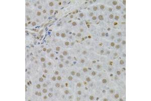 Immunohistochemistry of paraffin-embedded human liver using SFN Antibody. (14-3-3 sigma/SFN 抗体  (AA 1-248))