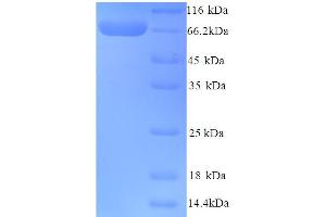 SDS-PAGE (SDS) image for Butyrylcholinesterase (BCHE) (AA 29-602) protein (His tag) (ABIN5713278) (Butyrylcholinesterase Protein (BCHE) (AA 29-602) (His tag))