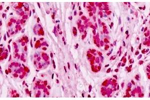 Human Breast, Epithelium: Formalin-Fixed, Paraffin-Embedded (FFPE) (UBE2D1 抗体  (AA 1-95))