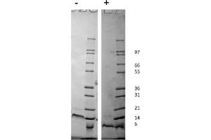 SDS-PAGE of Human Stromal Cell-Derived Factor-1 alpha (CXCL12) Recombinant Protein.