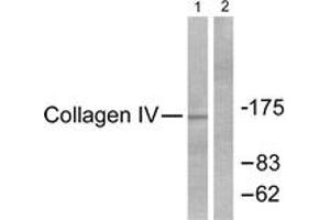 Western blot analysis of extracts from HeLa cells, using Collagen IV Antibody. (Collagen IV 抗体  (AA 11-60))