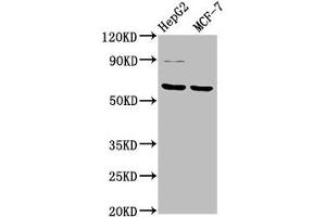Western Blot Positive WB detected in: HepG2 whole cell lysate, MCF-7 whole cell lysate All lanes: FPGS antibody at 3. (FPGS 抗体  (AA 443-546))