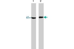 Western blot of A-431 cells untreated (lane 1) or treated with pervanadate (lane 2). (PDPK1 抗体  (N-Term))