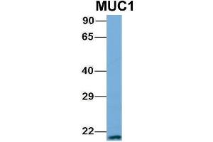 Host:  Rabbit  Target Name:  MUC1  Sample Type:  721_B  Antibody Dilution:  1. (MUC1 抗体  (N-Term))