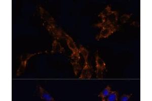 Immunofluorescence analysis of NIH/3T3 cells using TGFB1 Polyclonal Antibody at dilution of 1:100. (TGFB1 抗体)