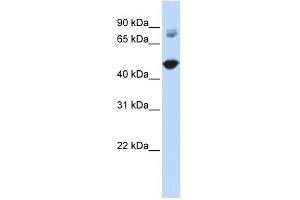 TBC1D16 antibody used at 1 ug/ml to detect target protein.