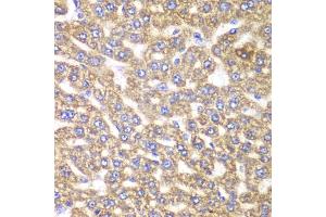 Immunohistochemistry of paraffin-embedded rat liver using UGDH antibody (ABIN6293152) at dilution of 1:100 (40x lens). (UGDH 抗体)