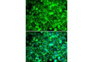 Immunofluorescence analysis of U2OS cells using ADIPOR1 antibody (ABIN5970705). (Adiponectin Receptor 1 抗体)