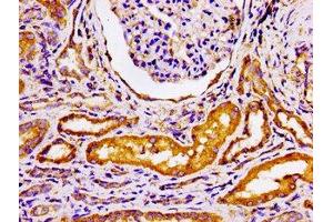Immunohistochemistry of paraffin-embedded human kidney tissue using ABIN7145438 at dilution of 1:100 (ADRBK2 抗体  (AA 343-480))