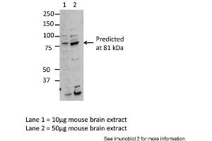 Sample Type: Lane1 = 10ug mouse brain extract, Lane 2 = 50ug mouse brain extractPrimary Antibody Dilution: Anti-MARK3 1:2500Submitted By: Dr. (MARK3 抗体  (Middle Region))