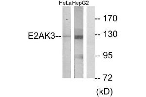 Western Blotting (WB) image for anti-Eukaryotic Translation Initiation Factor 2-alpha Kinase 3 (EIF2AK3) (N-Term) antibody (ABIN1850024) (PERK 抗体  (N-Term))
