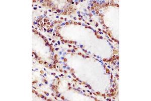 (ABIN6243590 and ABIN6578256) staining HNRNPUL2 in human stomach tissue sections by Immunohistochemistry (IHC-P - paraformaldehyde-fixed, paraffin-embedded sections). (HNRNPUL2 抗体  (AA 337-350))