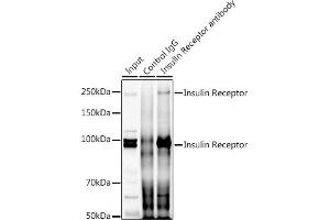 Immunoprecipitation analysis of 300 μg extracts of HeLa cells using 3 μg Insulin Receptor antibody (ABIN7267890). (Insulin Receptor 抗体  (AA 1281-1382))