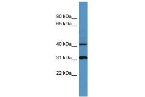 WB Suggested Anti-Ctsd Antibody Titration: 0. (Cathepsin D 抗体  (C-Term))