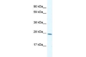Western Blotting (WB) image for anti-General Transcription Factor IIF, Polypeptide 2, 30kDa (GTF2F2) (C-Term) antibody (ABIN2777296)
