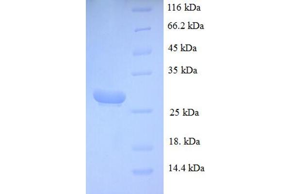 Myonase Protein (MCPT4) (AA 21-246) (His tag)